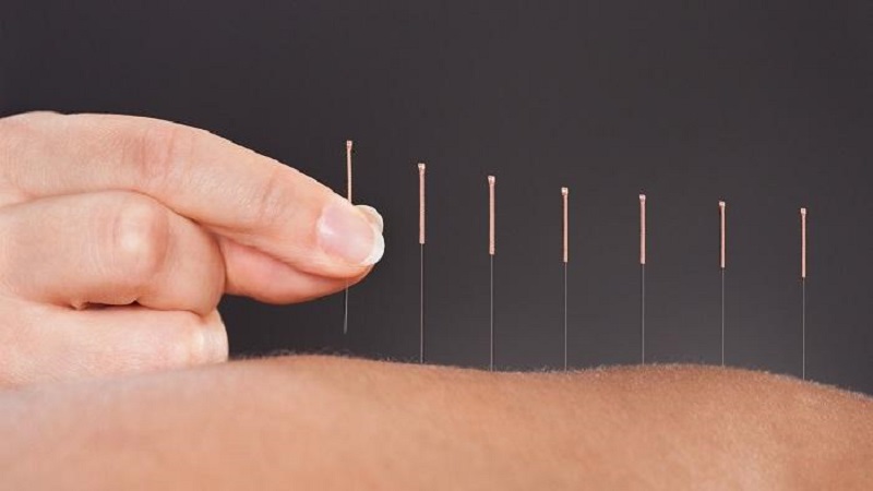 بهترین متخصص طب سنتی اصفهان | . درمان چاقی با روش طب سوزنی چینی .