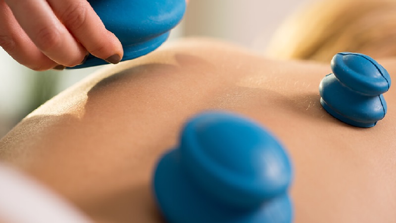 بهترین متخصص طب سنتی اصفهان | دکتر طب سنتی اصفهان | بادکش درمانی