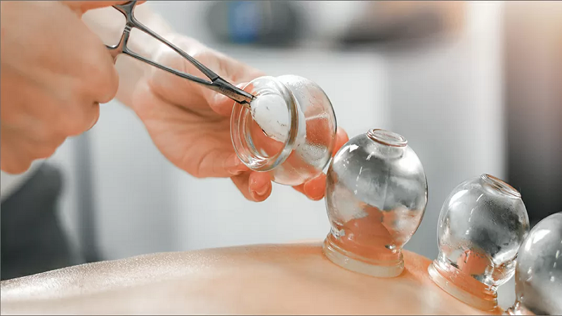 بهترین متخصص طب سنتی اصفهان | دکتر طب سنتی اصفهان | بادکش درمانی از افزایش گردش خون تا دفع سموم بدن