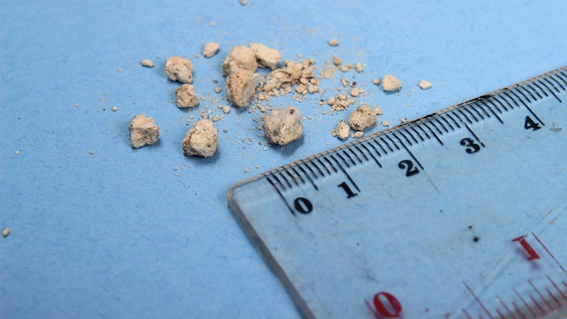 بهترین متخصص طب سنتی اصفهان | دکتر طب سنتی اصفهان | . نگاهی به راهکارهای موثر با حجامت، فصد و گیاهان دارویی