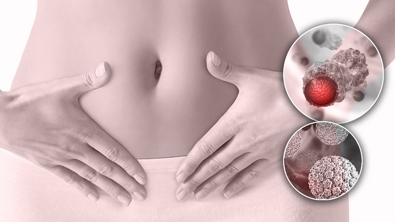 ویزیت طب سنتی در اصفهان | درمان بیماری با طب سنتی در اصفهان | دکتر مجتبی معتمدی | بهترین متخصص طب سنتی اصفهان | راهکارهای مؤثر طب سنتی برای پیشگیری از ابتلا به ویروس HPV